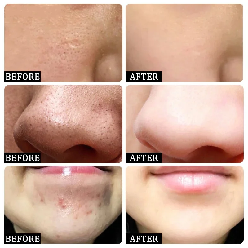 Salicylic Acid Pore Clearing C - Korean Skincare Routine 评论和价格